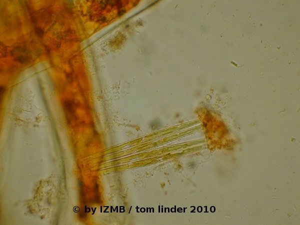 Cladophora chrysoidine staining
