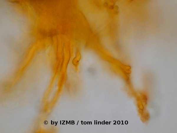 Acridine orange staining of rhizoids of Enteromorpha sp.