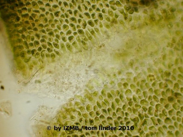 Enteromorpha sp. Lugol staining
