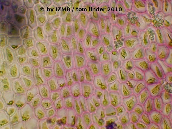 Toluidine staining Enteromorpha sp.