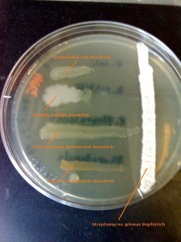 Streptomycin Test-Agar